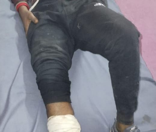 जौनपुर।पुलिस मुठभेड़ में एक शातिर पशु तस्कर गिरफ्तार 