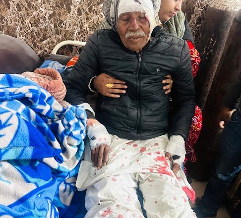 हापुड़।बेटे ने दोस्त के साथ मिलकर वृद्ध पिता पर जानलेवा हमला कर किया घायल।