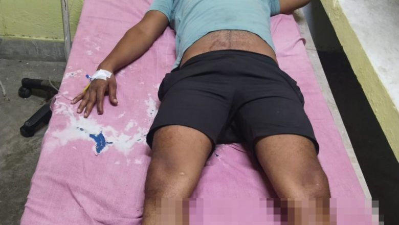 जौनपुर।थाना केराकत में मुठभेड़ के बाद अंतर्जनपदीय लुटेरा घायल, गिरफ्तार, लूट का सोना बरामद